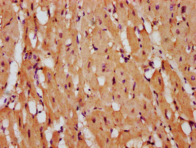 IHC image of the antibody diluted at 1:400 and staining in paraffin-embedded human heart tissue performed on a Leica BondTM system. After dewaxing and hydration, antigen retrieval was mediated by high pressure in a citrate buffer (pH 6.0). Section was blocked with 10% normal goat serum 30min at RT. Then primary antibody (1% BSA) was incubated at 4°C overnight. The primary is detected by a biotinylated secondary antibody and visualized using an HRP conjugated SP system.Rabbit anti-Human PTPRK Polyclonal Antibody