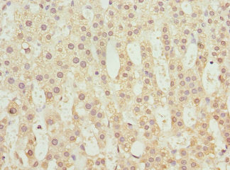 Immunohistochemistry of paraffin-embedded human adrenal gland tissue using TBCE Antibody at dilution of 1:100Rabbit anti-Human TBCE Polyclonal Antibody