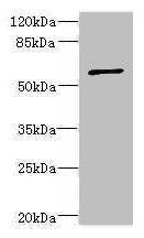 Western blot  | All lanes: TBCE antibody at 5.55µg/ml + CEM whole cell lysate  | Secondary  | Goat polyclonal to rabbit IgG at 1/10000 dilution  | Predicted band size: 60, 65 kDa  | Observed band size: 60 kDaRabbit anti-Human TBCE Polyclonal Antibody