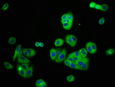 Immunofluorescence staining of HepG2 cells with KCNJ8 Antibody at 1:166, counter-stained with DAPI. The cells were fixed in 4% formaldehyde, permeabilized using 0.2% Triton X-100 and blocked in 10% normal Goat Serum. The cells were then incubated with the antibody overnight at 4°C. The secondary antibody was Alexa Fluor 488-congugated AffiniPure Goat Anti-Rabbit IgG(H+L).