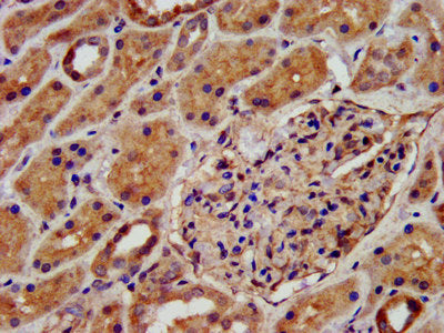 IHC image of the antibody diluted at 1:500 and staining in paraffin-embedded human kidney tissue performed on a Leica BondTM system. After dewaxing and hydration, antigen retrieval was mediated by high pressure in a citrate buffer (pH 6.0). Section was blocked with 10% normal goat serum 30min at RT. Then primary antibody (1% BSA) was incubated at 4°C overnight. The primary is detected by a biotinylated secondary antibody and visualized using an HRP conjugated SP system.