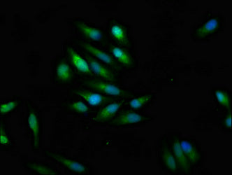 Immunofluorescence staining of Hela cells with SCN9A Antibody at 1:100, counter-stained with DAPI. The cells were fixed in 4% formaldehyde, permeabilized using 0.2% Triton X-100 and blocked in 10% normal Goat Serum. The cells were then incubated with the antibody overnight at 4°C. The secondary antibody was Alexa Fluor 488-congugated AffiniPure Goat Anti-Rabbit IgG(H+L).Rabbit anti-Human SCN9A Polyclonal Antibody