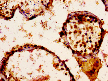 IHC image of SCN9A Antibody diluted at 1:300 and staining in paraffin-embedded human testis tissue performed on a Leica BondTM system. After dewaxing and hydration, antigen retrieval was mediated by high pressure in a citrate buffer (pH 6.0). Section was blocked with 10% normal goat serum 30min at RT. Then primary antibody (1% BSA) was incubated at 4°C overnight. The primary is detected by a biotinylated secondary antibody and visualized using an HRP conjugated ABC system.Rabbit anti-Human SCN9A Polyclonal Antibody