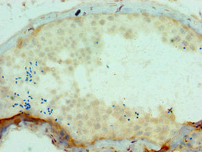 Immunohistochemistry of paraffin-embedded human testis tissue using SSX2 Antibody at dilution of 1:100Rabbit anti-Human SSX2 Polyclonal Antibody