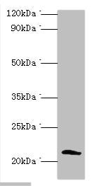 Western blot | All lanes: Protein SSX2 antibody at 2μg/ml + MDA-MB-231 whole cell lysate | Secondary | Goat polyclonal to rabbit IgG at 1/10000 dilution | Predicted band size: 22, 26 kDa | Observed band size: 22 kDaRabbit anti-Human SSX2 Polyclonal Antibody