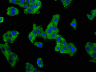 Immunofluorescence staining of HepG2 cells with ASIC2 Antibody at 1:100, counter-stained with DAPI. The cells were fixed in 4% formaldehyde, permeabilized using 0.2% Triton X-100 and blocked in 10% normal Goat Serum. The cells were then incubated with the antibody overnight at 4°C. The secondary antibody was Alexa Fluor 488-congugated AffiniPure Goat Anti-Rabbit IgG(H+L).Rabbit anti-Human ASIC2 Polyclonal Antibody