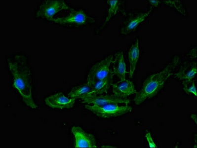 Immunofluorescent analysis of Hela cells using CDC37 Antibody at dilution of 1:100 and Alexa Fluor 488-congugated AffiniPure Goat Anti-Rabbit IgG(H+L)Rabbit anti-Human CDC37 Polyclonal Antibody