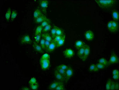 Immunofluorescence staining of HepG2 cells with GUCA2B Antibody at 1:100, counter-stained with DAPI. The cells were fixed in 4% formaldehyde, permeabilized using 0.2% Triton X-100 and blocked in 10% normal Goat Serum. The cells were then incubated with the antibody overnight at 4°C. The secondary antibody was Alexa Fluor 488-congugated AffiniPure Goat Anti-Rabbit IgG(H+L).Rabbit anti-Human GUCA2B Polyclonal Antibody