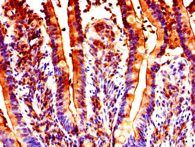 IHC image of GUCA2B Antibody diluted at 1:300 and staining in paraffin-embedded human small intestine tissue performed on a Leica BondTM system. After dewaxing and hydration, antigen retrieval was mediated by high pressure in a citrate buffer (pH 6.0). Section was blocked with 10% normal goat serum 30min at RT. Then primary antibody (1% BSA) was incubated at 4°C overnight. The primary is detected by a biotinylated secondary antibody and visualized using an HRP conjugated SP system.Rabbit anti-Human GUCA2B Polyclonal Antibody