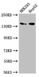 Western Blot | Positive WB detected in: HEK293 whole cell lysate, HepG2 whole cell lysate | All lanes: MAN2A1 antibody at 3.5μg/ml | Secondary | Goat polyclonal to rabbit IgG at 1/50000 dilution | Predicted band size: 132 kDa | Observed band size: 150 kDa