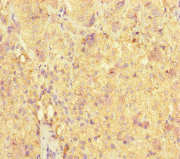 Immunohistochemistry of paraffin-embedded human adrenal gland tissue using ME3 Antibody at dilution of 1:100Rabbit anti-Human ME3 Polyclonal Antibody