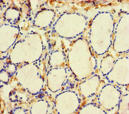 Immunohistochemistry of paraffin-embedded human thyroid tissue using ME3 Antibody at dilution of 1:100Rabbit anti-Human ME3 Polyclonal Antibody