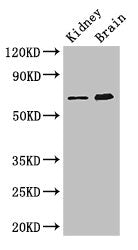 Western Blot | Positive WB detected in: Mouse kidney tissue, Mouse brain tissue | All lanes: ME3 antibody at 3μg/ml | Secondary | Goat polyclonal to rabbit IgG at 1/50000 dilution | Predicted band size: 68, 39 kDa | Observed band size: 68 kDa