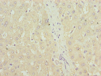 Immunohistochemistry of paraffin-embedded human liver tissue using TXNRD1 Antibody at dilution of 1:100Rabbit anti-Human TXNRD1 Polyclonal Antibody