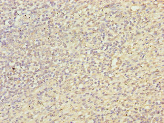 Immunohistochemistry of paraffin-embedded human spleen tissue using TXNRD1 Antibody at dilution of 1:100Rabbit anti-Human TXNRD1 Polyclonal Antibody