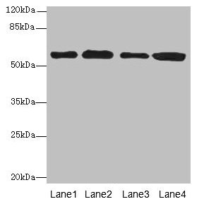 Western blot  | All lanes: TXNRD1 antibody at 5µg/ml  | Lane 1: Jurkat whole cell lysate  | Lane 2: A549 whole cell lysate  | Lane 3: MCF-7 whole cell lysate  | Lane 4: Hela whole cell lysate  | Secondary  | Goat polyclonal to rabbit IgG at 1/10000 dilution  | Predicted band size: 71, 60, 66, 61, 55, 68, 51 kDa  | Observed band size: 60 kDaRabbit anti-Human TXNRD1 Polyclonal Antibody