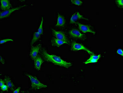 Immunofluorescent analysis of Hela cells using KCNMA1 Antibody at dilution of 1:100 and Alexa Fluor 488-congugated AffiniPure Goat Anti-Rabbit IgG(H+L)