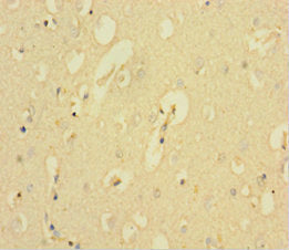 Immunohistochemistry of paraffin-embedded human brain tissue using the antibody at dilution of 1:100