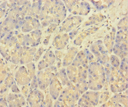 Immunohistochemistry of paraffin-embedded human pancreatic tissue using KCNMA1 Antibody at dilution of 1:100