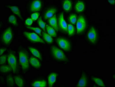 Immunofluorescence staining of A549 cells with PTPN13 Antibody at 1:100, counter-stained with DAPI. The cells were fixed in 4% formaldehyde, permeabilized using 0.2% Triton X-100 and blocked in 10% normal Goat Serum. The cells were then incubated with the antibody overnight at 4°C. The secondary antibody was Alexa Fluor 488-congugated AffiniPure Goat Anti-Rabbit IgG(H+L).Rabbit anti-Human PTPN13 Polyclonal Antibody