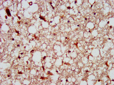 IHC image of the antibody diluted at 1:300 and staining in paraffin-embedded human brain tissue performed on a Leica BondTM system. After dewaxing and hydration, antigen retrieval was mediated by high pressure in a citrate buffer (pH 6.0). Section was blocked with 10% normal goat serum 30min at RT. Then primary antibody (1% BSA) was incubated at 4°C overnight. The primary is detected by a biotinylated secondary antibody and visualized using an HRP conjugated SP system.Rabbit anti-Human PTPN13 Polyclonal Antibody
