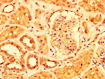 IHC image of USP4 Antibody diluted at 1:500 and staining in paraffin-embedded human kidney tissue performed on a Leica BondTM system. After dewaxing and hydration, antigen retrieval was mediated by high pressure in a citrate buffer (pH 6.0). Section was blocked with 10% normal goat serum 30min at RT. Then primary antibody (1% BSA) was incubated at 4°C overnight. The primary is detected by a biotinylated secondary antibody and visualized using an HRP conjugated SP system.Rabbit anti-Human USP4 Polyclonal Antibody