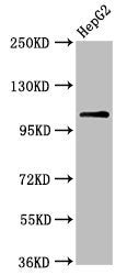 Western Blot  | Positive WB detected in: HepG2 whole cell lysate  | All lanes: USP4 antibody at 6.3µg/ml  | Secondary  | Goat polyclonal to rabbit IgG at 1/50000 dilution  | Predicted band size: 109, 104, 36 kDa  | Observed band size: 109 kDaRabbit anti-Human USP4 Polyclonal Antibody