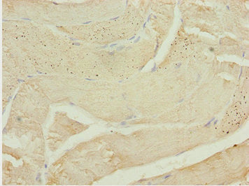 Immunohistochemistry of paraffin-embedded human skeletal muscle tissue using CALCOCO2 Antibody at dilution of 1:100