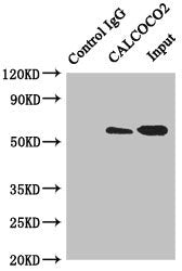 Immunoprecipitating CALCOCO2 in Hela whole cell lysate | Lane 1: Rabbit control IgG instead of (1μg) instead of CALCOCO2 Antibody in Hela whole cell lysate. | For western blotting, a HRP-conjugated anti-rabbit IgG, specific to the non-reduced form of IgG was used as the Secondary antibody (1/50000) | Lane 2: CALCOCO2 Antibody (4μg) + Hela whole cell lysate (500μg) | Lane 3: Hela whole cell lysate (20μg)