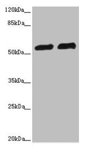 Western blot | All lanes: CALCOCO2 antibody at 3.36μg/ml | Lane 1: Hela whole cell lysate | Lane 2: Raji whole cell lysate | Secondary | Goat polyclonal to rabbit IgG at 1/10000 dilution | Predicted band size: 53, 48, 55, 56, 44 kDa | Observed band size: 56 kDa