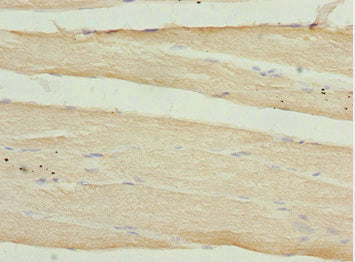 Immunohistochemistry of paraffin-embedded human skeletal muscle tissue using CALCOCO2 Antibody at dilution of 1:100