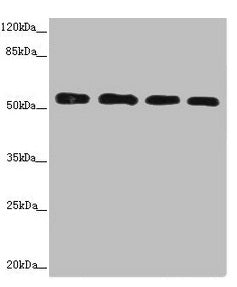 Western blot | All lanes: CALCOCO2 antibody at 3.66μg/ml | Lane 1: Hela whole cell lysate | Lane 2: Jurkat whole cell lysate | Lane 3: 293T whole cell lysate | Lane 4: Raji whole cell lysate | Secondary | Goat polyclonal to rabbit IgG at 1/10000 dilution | Predicted band size: 53, 48, 55, 56, 44 kDa | Observed band size: 56 kDa