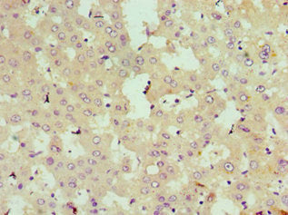 Immunohistochemistry of paraffin-embedded human liver tissue using STK3 Antibody at dilution of 1:100Rabbit anti-Human STK3 Polyclonal Antibody