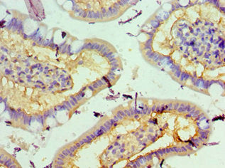 Immunohistochemistry of paraffin-embedded human small intestine tissue using STK3 Antibody at dilution of 1:100Rabbit anti-Human STK3 Polyclonal Antibody