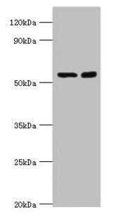 Western blot  | All lanes: STK3 antibody at 8µg/ml  | Lane 1: Hela whole cell lysate  | Lane 2: NIH/3T3 whole cell lysate  | Secondary  | Goat polyclonal to rabbit IgG at 1/10000 dilution  | Predicted band size: 57, 60 kDa  | Observed band size: 57 kDaRabbit anti-Human STK3 Polyclonal Antibody