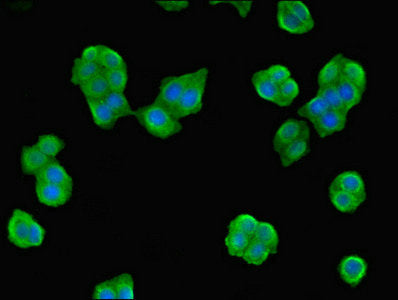 Immunofluorescent analysis of PC-3 cells using NME3 Antibody at dilution of 1:100 and Alexa Fluor 488-congugated AffiniPure Goat Anti-Rabbit IgG(H+L)Rabbit anti-Human NME3 Polyclonal Antibody