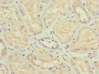 Immunohistochemistry of paraffin-embedded human kidney tissue using the antibody at dilution of 1:100Rabbit anti-Human NME3 Polyclonal Antibody