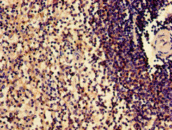Immunohistochemistry of paraffin-embedded human spleen tissue using the antibody at dilution of 1:100Rabbit anti-Human SLAMF1 Polyclonal Antibody