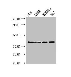 Western Blot  | Positive WB detected in: PC-3 whole cell lysate, K562 whole cell lysate, HEK293 whole cell lysate, U87 whole cell lysate  | All lanes: SLAMF1 antibody at 3μg/ml  | Secondary  | Goat polyclonal to rabbit IgG at 1/50000 dilution  | Predicted band size: 38, 34, 41 kDa  | Observed band size: 38 kDaRabbit anti-Human SLAMF1 Polyclonal Antibody