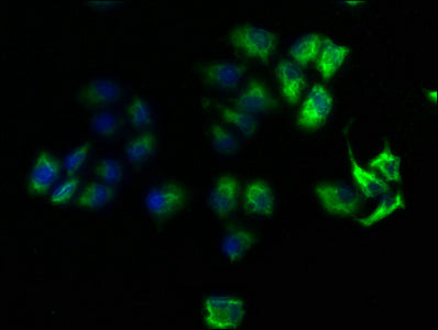 Immunofluorescence staining of Hela cells with ROCK1 Antibody at 1:100, counter-stained with DAPI. The cells were fixed in 4% formaldehyde, permeabilized using 0.2% Triton X-100 and blocked in 10% normal Goat Serum. The cells were then incubated with the antibody overnight at 4°C. The secondary antibody was Alexa Fluor 488-congugated AffiniPure Goat Anti-Rabbit IgG(H+L).Rabbit anti-Human ROCK1 Polyclonal Antibody