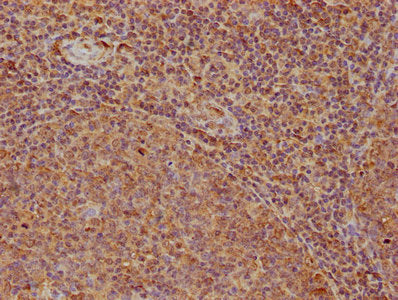 IHC image of ROCK1 Antibody diluted at 1:200 and staining in paraffin-embedded human tonsil tissue performed on a Leica BondTM system. After dewaxing and hydration, antigen retrieval was mediated by high pressure in a citrate buffer (pH 6.0). Section was blocked with 10% normal goat serum 30min at RT. Then primary antibody (1% BSA) was incubated at 4°C overnight. The primary is detected by a biotinylated secondary antibody and visualized using an HRP conjugated SP system.Rabbit anti-Human ROCK1 Polyclonal Antibody