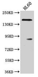 Western Blot  | Positive WB detected in: HL60 whole cell lysate  | All lanes: ROCK1 antibody at 1:2000  | Secondary  | Goat polyclonal to rabbit IgG at 1/50000 dilution  | Predicted band size: 159 kDa  | Observed band size: 159 kDaRabbit anti-Human ROCK1 Polyclonal Antibody