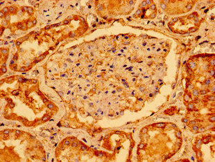 Immunohistochemistry of paraffin-embedded human kidney tissue using the antibody at dilution of 1:100Rabbit anti-Human GAB1 Polyclonal Antibody