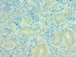 Immunohistochemistry of paraffin-embedded human pancreatic tissue using MTM1 Antibody at dilution of 1:100Rabbit anti-Human MTM1 Polyclonal Antibody