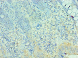 Immunohistochemistry of paraffin-embedded human epityphlon tissue using MTM1 Antibody at dilution of 1:100Rabbit anti-Human MTM1 Polyclonal Antibody