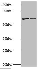 Western blot | All lanes: Myotubularin antibody at 2μg/ml | Lane 1: Jurkat whole cell lysate | Lane 2: HepG2 whole cell lysate | Secondary | Goat polyclonal to rabbit IgG at 1/10000 dilution | Predicted band size: 70, 67 kDa | Observed band size: 70 kDaRabbit anti-Human MTM1 Polyclonal Antibody