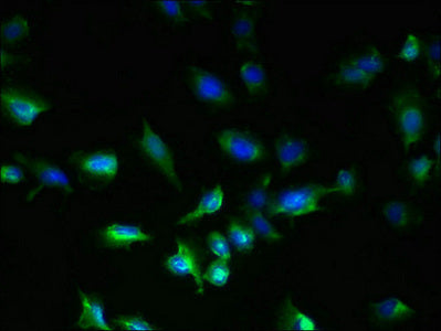 Immunofluorescent analysis of U251 cells using GPR18 Antibody at dilution of 1:100 and Alexa Fluor 488-congugated AffiniPure Goat Anti-Rabbit IgG(H+L)Rabbit anti-Human GPR18 Polyclonal Antibody