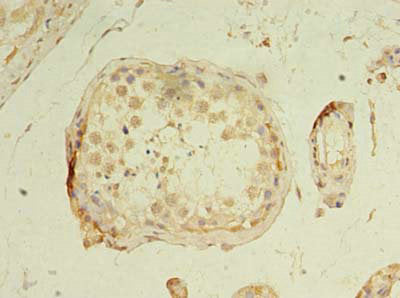 Immunohistochemistry of paraffin-embedded human testis tissue using GPR18 Antibody at dilution of 1:100Rabbit anti-Human GPR18 Polyclonal Antibody