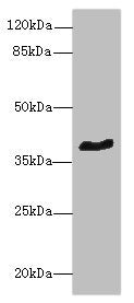Western blot  | All lanes: GPR18 antibody at 8µg/ml + Mouse brain tissue  | Secondary  | Goat polyclonal to rabbit IgG at 1/10000 dilution  | Predicted band size: 39 kDa  | Observed band size: 39 kDaRabbit anti-Human GPR18 Polyclonal Antibody