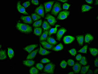 Immunofluorescence staining of Hela cells with CAPRIN1 Antibody at 1:66, counter-stained with DAPI. The cells were fixed in 4% formaldehyde, permeabilized using 0.2% Triton X-100 and blocked in 10% normal Goat Serum. The cells were then incubated with the antibody overnight at 4°C. The secondary antibody was Alexa Fluor 488-congugated AffiniPure Goat Anti-Rabbit IgG(H+L).